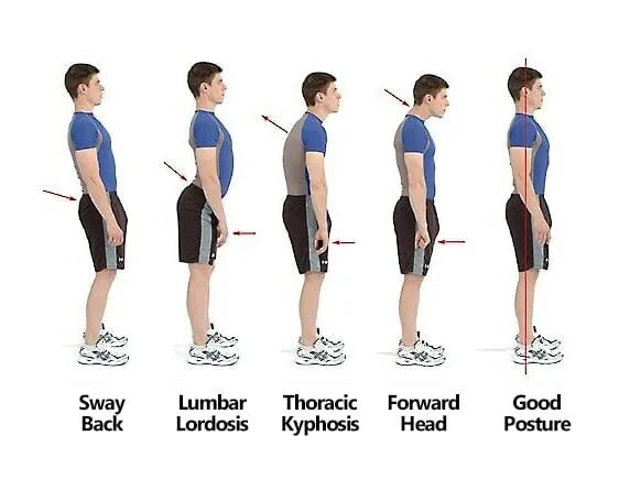6-Week Posture Correction Programme