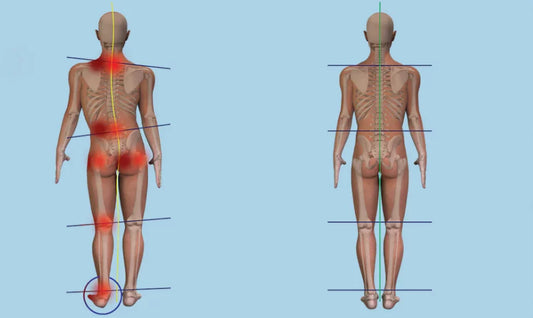 Sacroiliac joint pain and Short leg syndrome.