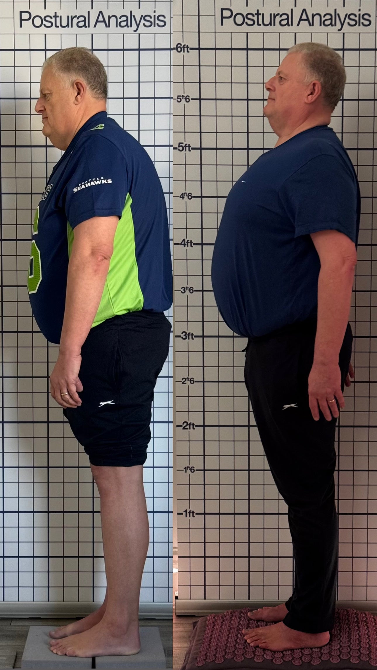Postural Correction & Analysis