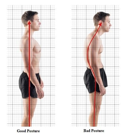 Posture assessment/correction