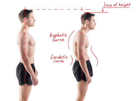 Posture Clinic: Posture Correction &amp; Back Pain Management, 6 weeks Programme