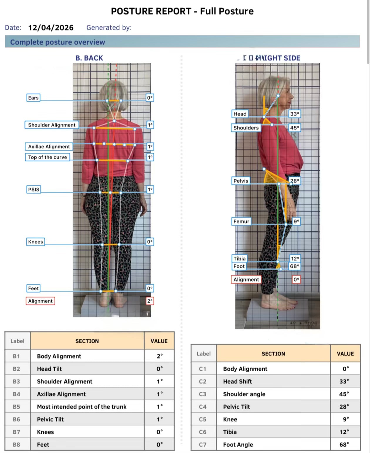 Postural Correction & Analysis