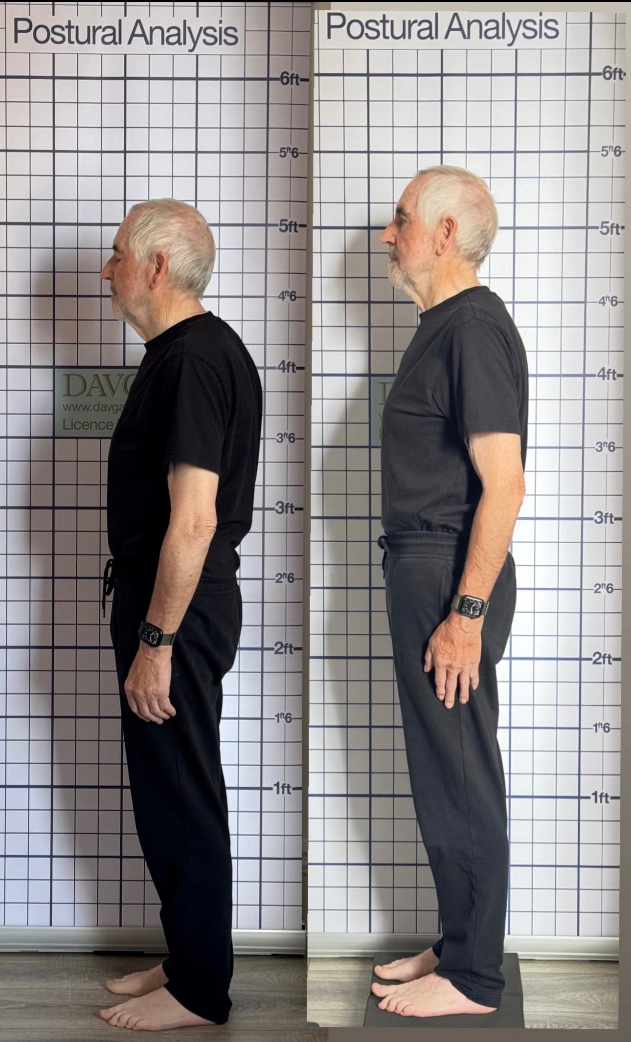 Postural Correction & Analysis