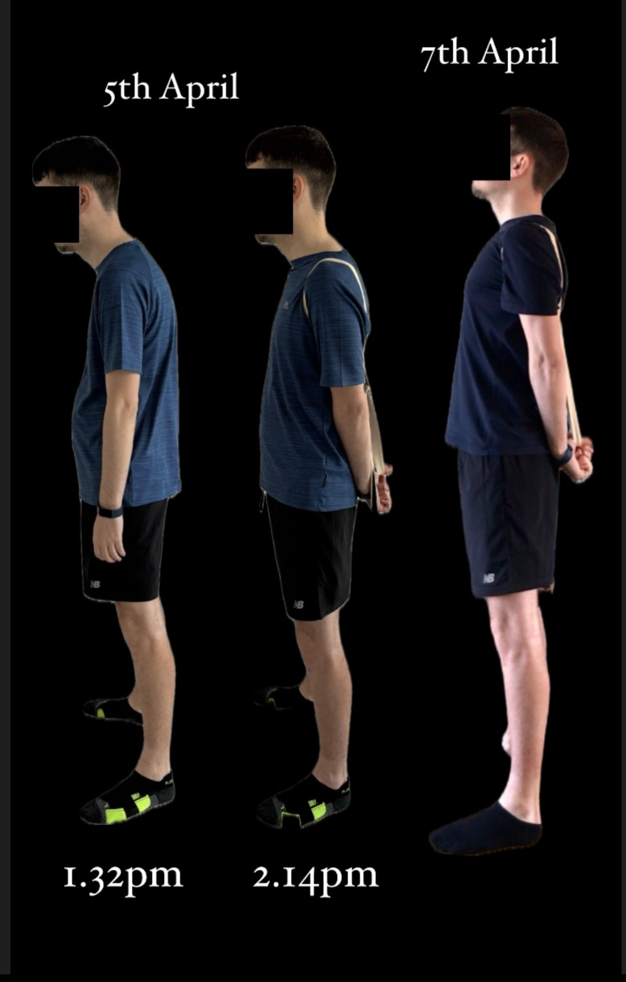 Posture assessment/correction