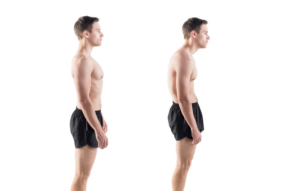 6-Week Posture Correction Programme