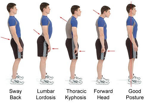 Posture assessment/correction