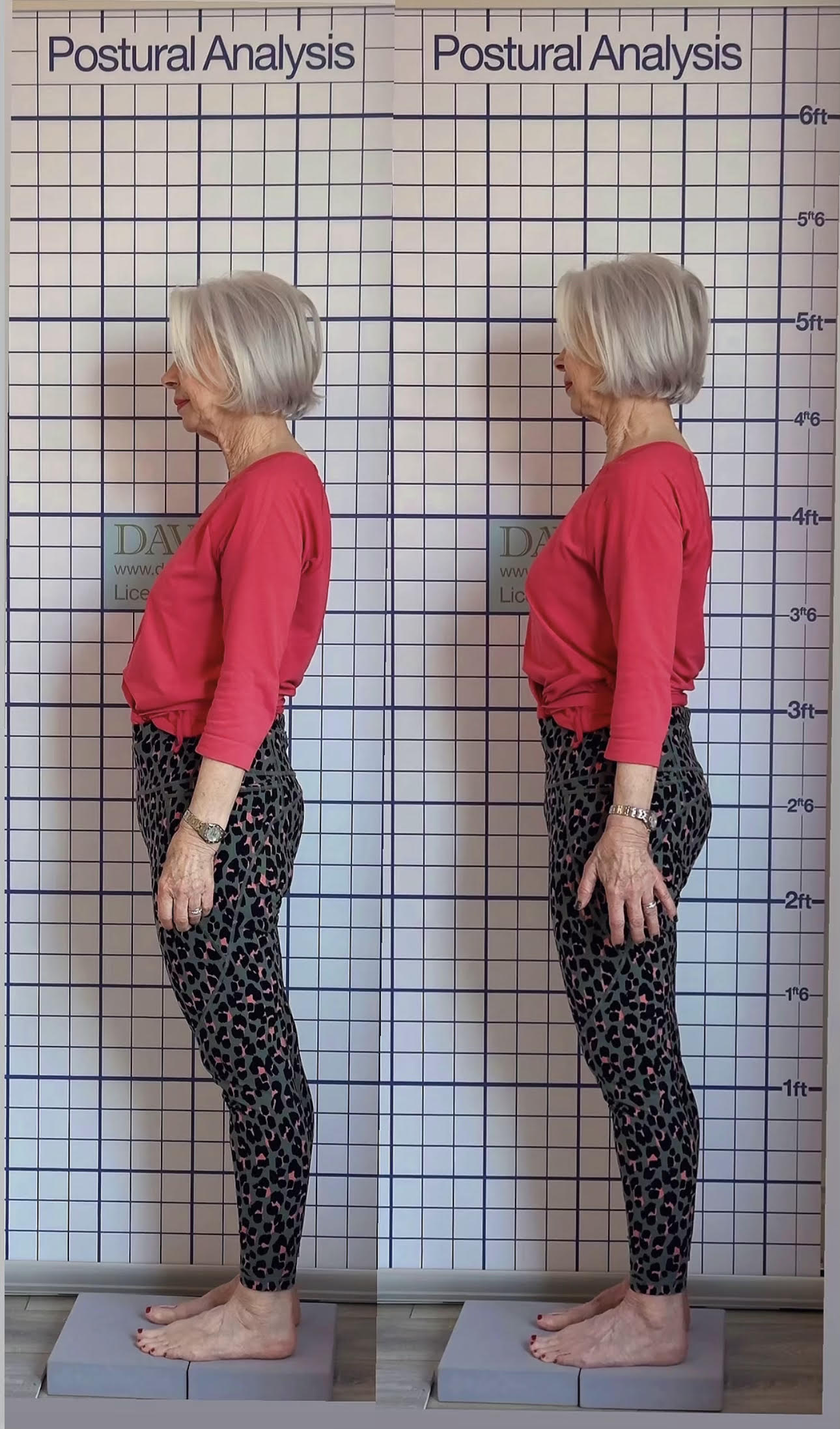 Postural Correction & Analysis